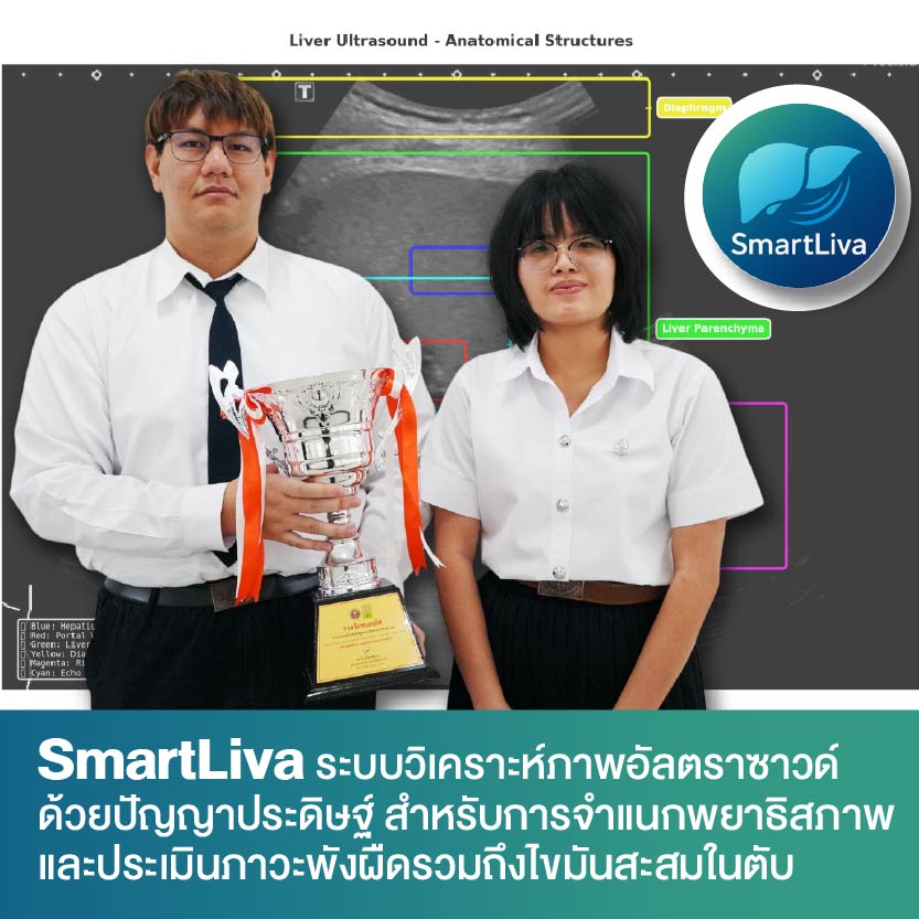 เด็ก มจธ.เจ๋ง ปั้น AI ตรวจค่า ‘ตับ’ รู้ผลใน 7 วินาที ลดเหลื่อมล้ำการรักษามะเร็งตับให้คนไทย