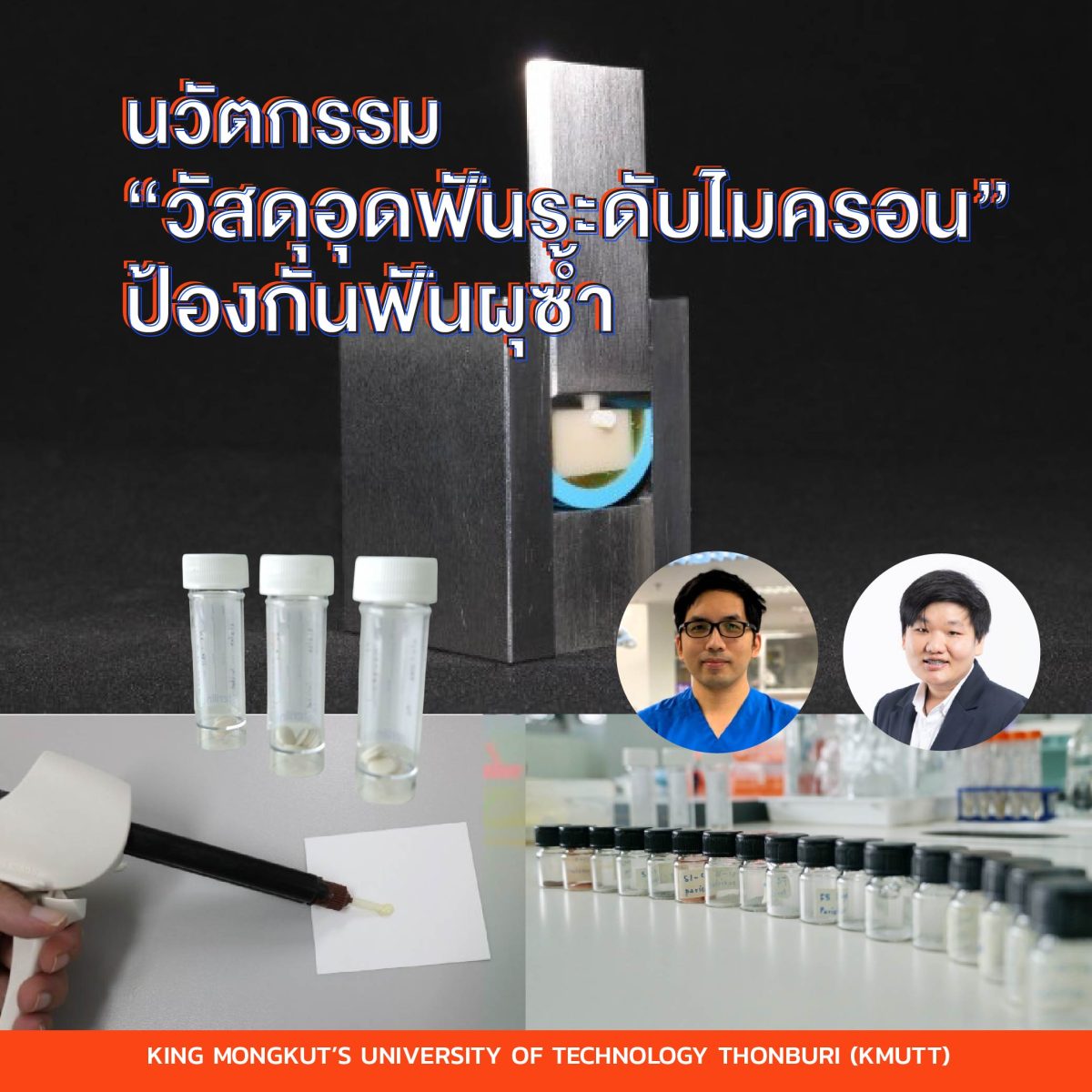มจธ. จับมือ มธ.พัฒนานวัตกรรม “วัสดุอุดฟันระดับไมครอน” ป้องกันฟันผุซ้ำ ลดการนำเข้าวัสดุ