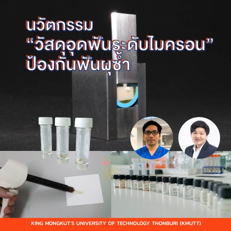 มจธ. จับมือ มธ.พัฒนานวัตกรรม “วัสดุอุดฟันระดับไมครอน” ป้องกันฟันผุซ้ำ ลดการนำเข้าวัสดุ